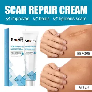 Scar Gel 20gr - Cream Penghilang Bekas Luka - Bekas Caesar - Keloid - Bekas Jahitan
