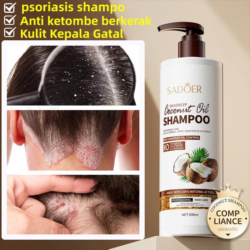 Shampo anti ketombe Penghilang ketombe berkerak dan gatal psoriasis kulit kepala Oil control Kulit kepala gatal Shampoo rambut 0