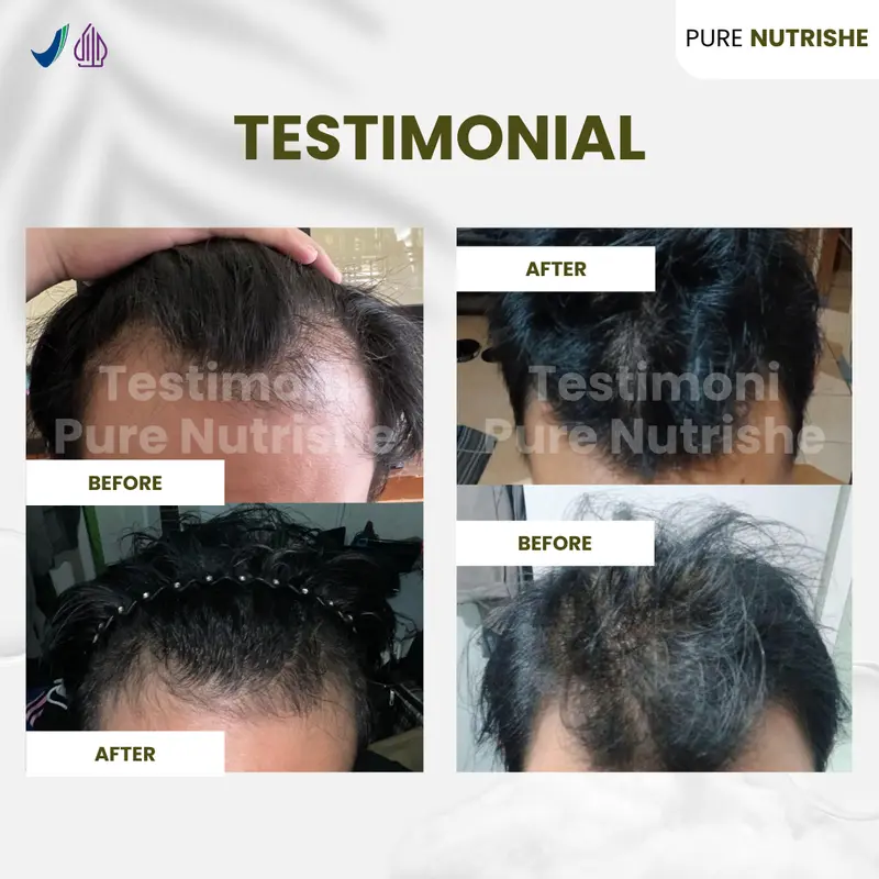 (60 ML) Rosemary Hair Oil Pure Nutrishe - Rosemary Hair Growth Oil - Minyak Penumbuh Rambut 5