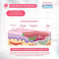 Gambar Labore Sensitive Skin Care AcnePro Biome Acne Spot Gel 15ml/Perawatan Jerawat - SPOT GEL 15ML dari Tokoserba serbu Kota Administrasi Jakarta Barat 5 Tokopedia