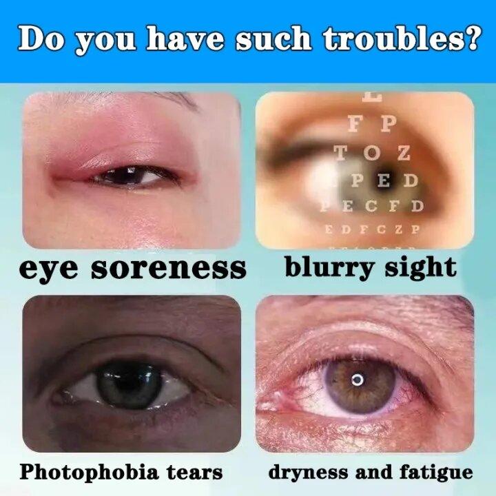 Eye Drops for Cataracts, Dry Eyes, Eye Pain, Red Bloodshot Eyes, Eye Strain 2