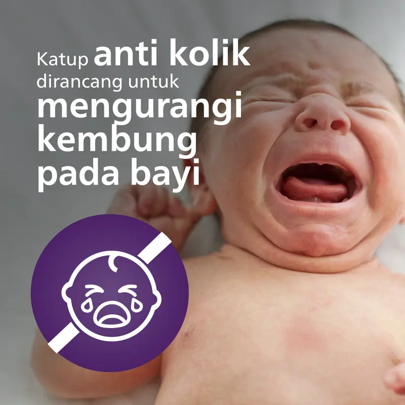 Philips Avent | Dot Bayi Botol Susu | Anti Kolik | Secara Klinis Mengurangi Kolik | 3M+ | SCY763/02 2