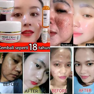 Spesialis Jerawat Paket Cream Fey Kinclong 4in1