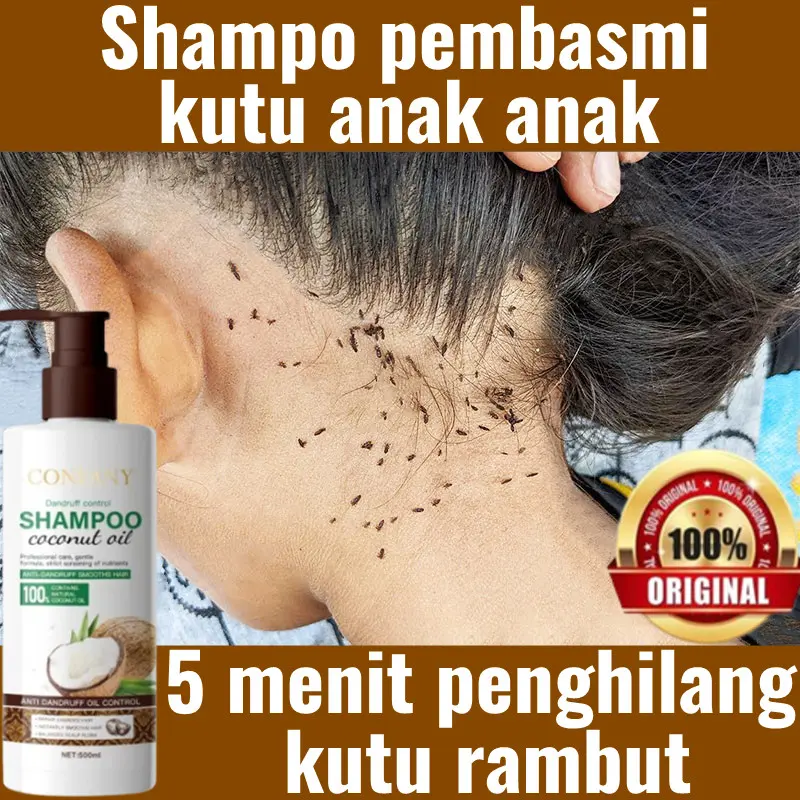 Sampo anti kutu rambut Obat kutu rambut Shampoo kutu rambut shampo penghilang kutu dan telurnya sampo kutu ketombe