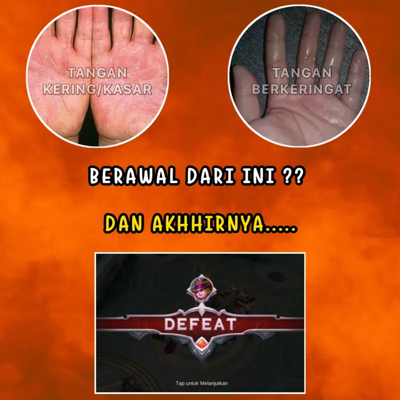 LOGO GAMING - SARUNG JEMPOL TANGAN JARI GAMER ROG RAZZRE BLACKSHARK ANTI BASAH LICIN PADA LAYAR HP 1