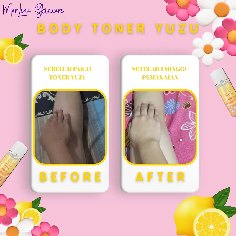 TONER LEMON YUZU WITH COLLAGEN  WHITENING BPOM 5