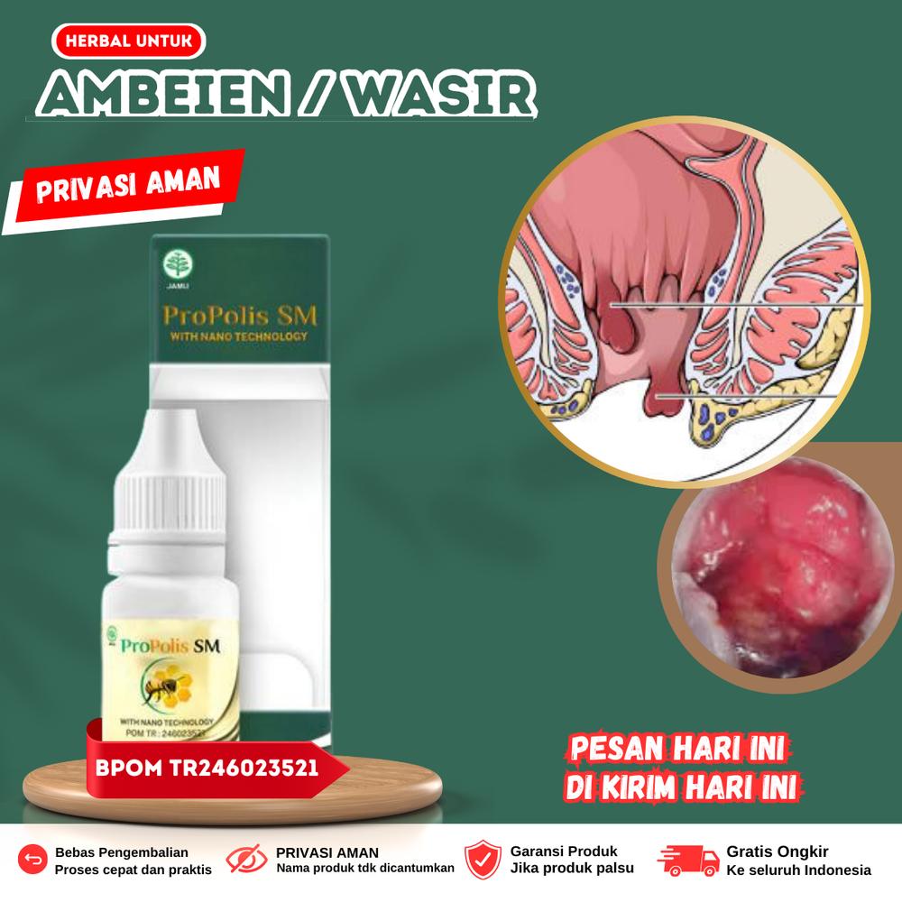 Salep Abses A.n.u.s, Oles Wasir / Ambeien, Benjolan, Fistula Ani, Fisura Anal, BAB Sakit, A.n.u.s Keluar Darah