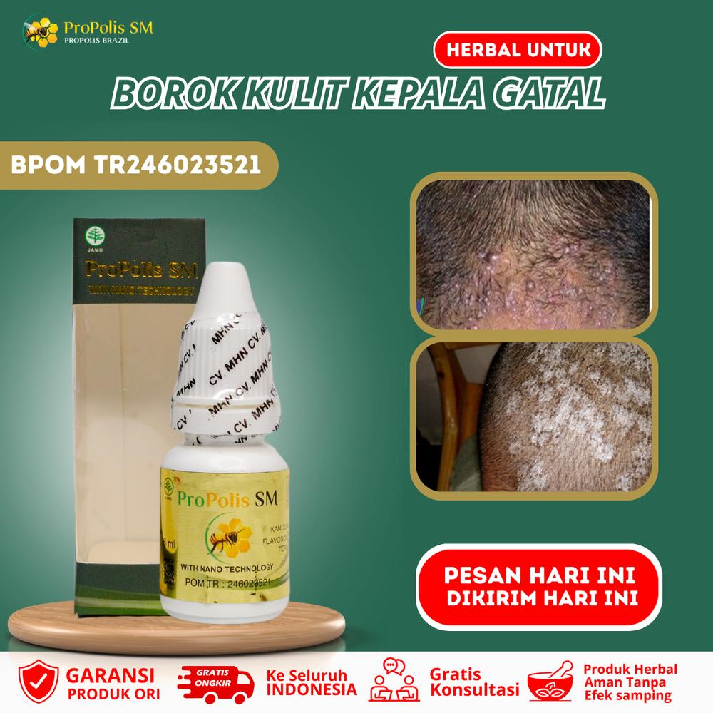 ProPolis SM - Cairan untuk Borok Kepala Infeksi Jamur Kulit Kepala Tinea Capitis Korengan - 6 ml