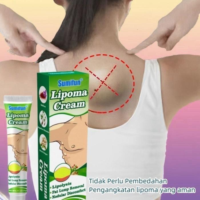 Product Introduction of sumifun lipoma solusi ampun menghilangkan benjolan 9