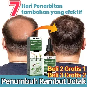 Serum Penumbuh Rambut Botak Rosemary Oil Rambut Obat Penumbuh Rambut Hair Growth Serum Minyak Penumbuh Rambut Botak
