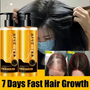 Ginseng Shampoo 300ml Anti Ketombe Gatal Rontok Fast Grow Shampo Anti Ketombe Kontrol Minyak Memperkuat Akar Rambut Menutrisi Folikel Rambut Meningkatkan Pertumbuhan Rambut dan Mencegah Rambut Rontok Root Activator Penumbuh Rambut Tebal