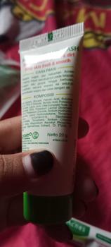 Product Review of NEW Acnes Starter Pack Acnes Treatment Series 3 Items from N**. 1
