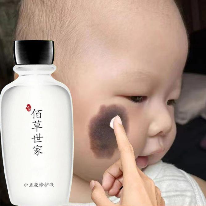 Birthmark Remover Solution 100g Birthmark Removal liquid for Black, red, brown birthmarks on face Quick Remove Birthmark Penyingkiran Tanda Lahir 0