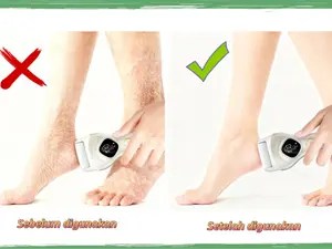 HATI-HATI! Kaki Kasar Anda Akan Kembali Sehalus Bayi dalam 1 Menit! Alat Pedikur Ajaib Ini SEDANG VIRAL LAGI! Klik BELI SEKARANG sebelum kehabisan stok!