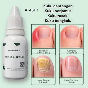 Hermoralux Toenail Serum – obat Kuku Cantengan, Kuku Tebal & Kuning .kuku berjamur kuku rusak kuku jempol dan tangan