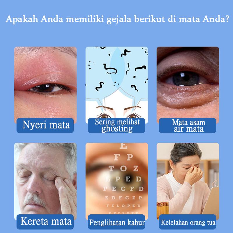 Tetes Mata Weter On Untuk Mata Minus Katarak Glaukoma Cylinder,Buram,Sliau Softlens Lens Eye 2