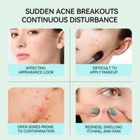 Gambar [OFFICIAL]LANBENA Acne Patch Malam & Siang – 4 Keunggulan Lawan Jerawat! Invisible, Percepat Sembuh,  1 Patch Bikin Jerawat Hilang! Tahan Air & Keringat, Anti Polusi, Cocok Pakai Sambil MakeUp - Acne patches [DAY] dari Lanbena.Indonesia Kab. Tangerang 2 Tokopedia
