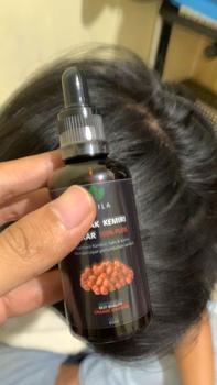 Product Review of Minyak Kemiri bakar murni Erdila penumbuh rambut 100% PURE ORIGINAL Menebalkan Menumbuhkan from H**m 0