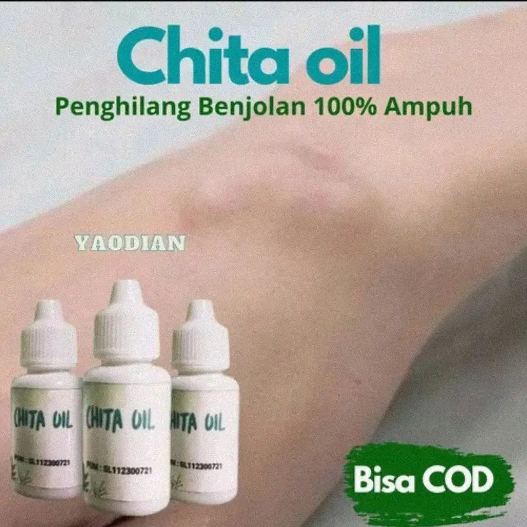 Chita oil minyak benjolan
