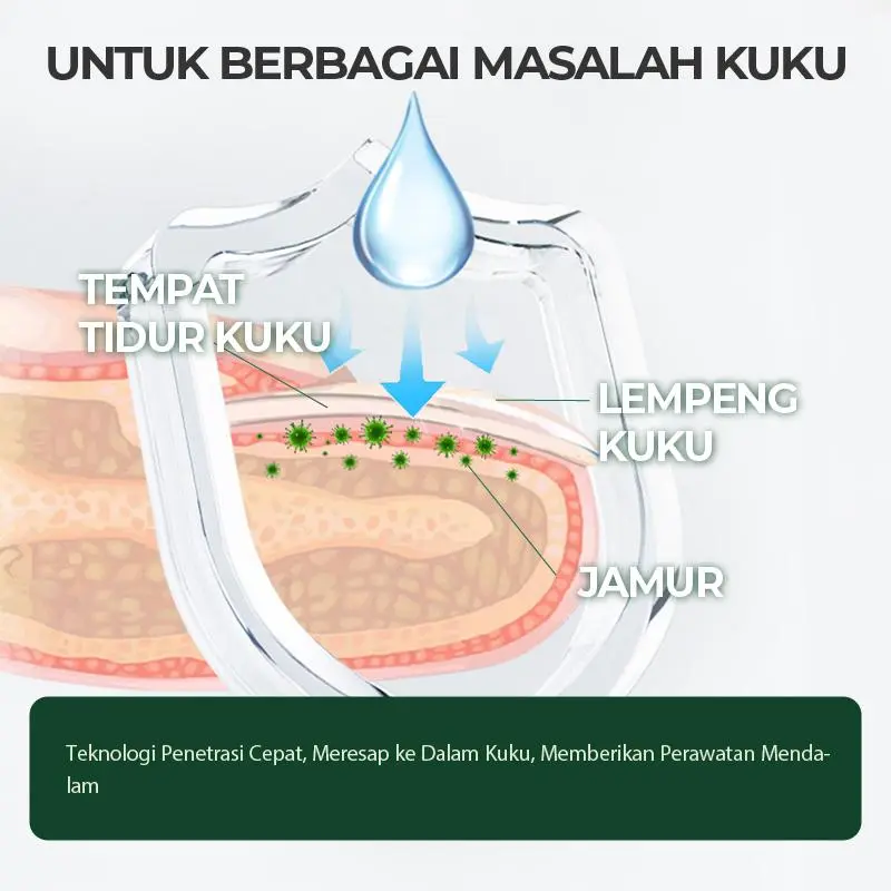 【A】Kreain Nature Nail Care Essence Esens Perawatan Kuku  Ekstrak Tea Tree dan Jahe untuk Perawatan 7 Hari 4