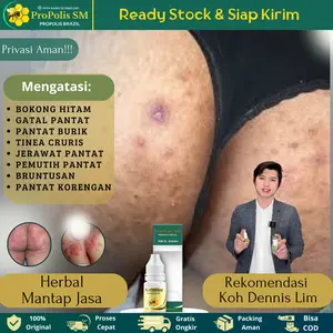 PROPOLIS SM - Salep pantat burik hitam, gatal pantat, korengan di pantat, pemutih pantat, tinea cruris, jamur pantat dan selangkangan, gatal kelamin