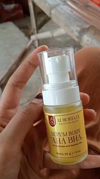 Product Review of Serum Body AHA BHA Almortaza from X**️ 0