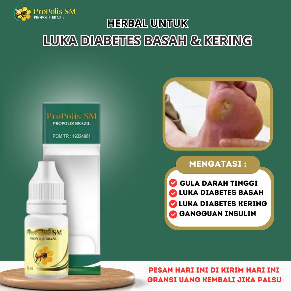 ProPolis SM untuk Luka Diabetes Basah Luka Kering Luka Bakar , Pembersih Bekas Luka Obat Herbal Tetes Oles