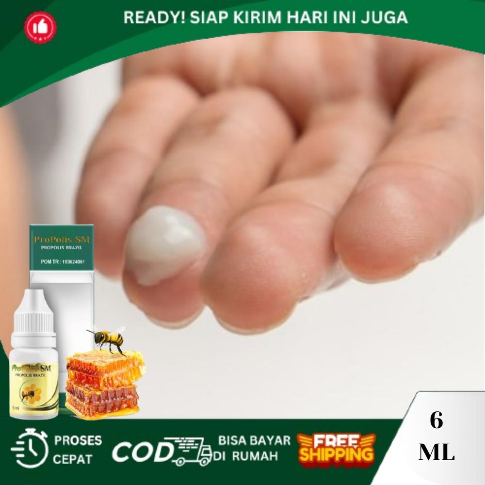 Propolis SM Penghilang Lendir Abnormal Keputihan Wanita, Infeksi Jamur Di Kelamin, Keputihan Bau Becek Gatal di Miss V Wanita