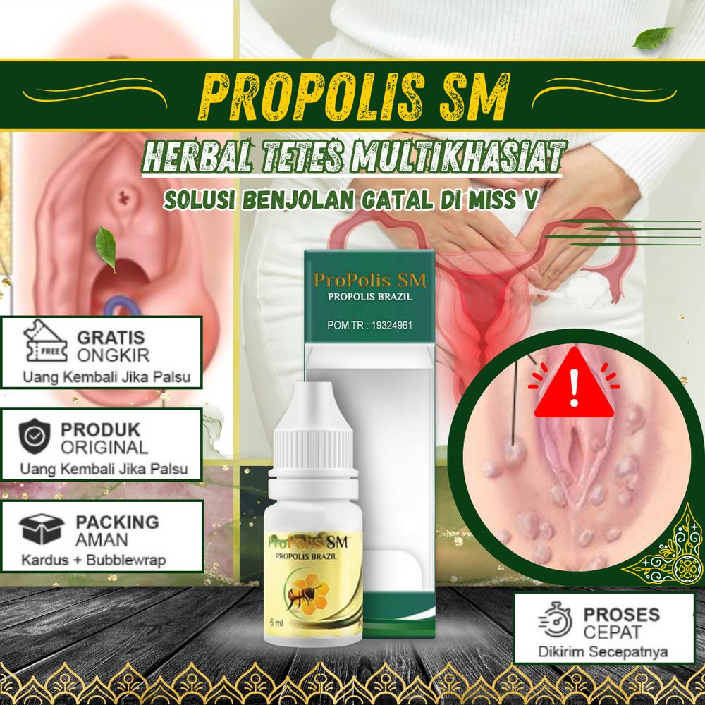 Propolis SM Solusi Gatal Miss V, Benjolan di MIss V, Gatal Area Kewanitaan, Benjolan di Selangkangan, Cair Tetes, Bersihkan Area Feminine
