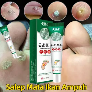 Obat Mata Ikan Pada Telapak Kaki, Perontok Mata Ikan di Telapak Kaki & Tangan, Mata Ikan Di Kaki, Penghilang Mata Ikan, Kapalan di Kaki Tangan Benjolan Keras di Telapak Kaki Salep Mata Ikan Mata Ikan Tumbuh Lagi Dengan