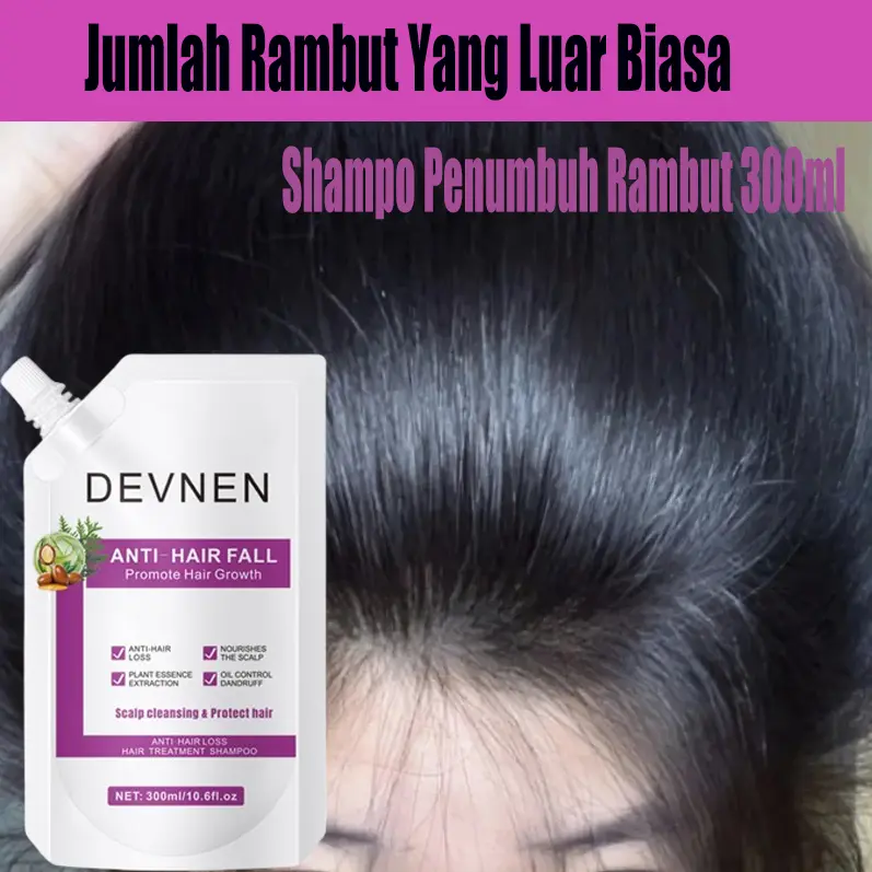 DEVNEN sampo anti rambut rontok 300ML Hair Growth Shampoo shampo penumbuh rambut cepat Anti rambut rontok Botak ginger shampoo kontrol minyak menyegarkan pelembab nutrisi Conditioner Haircare Ketombe Lebat 3
