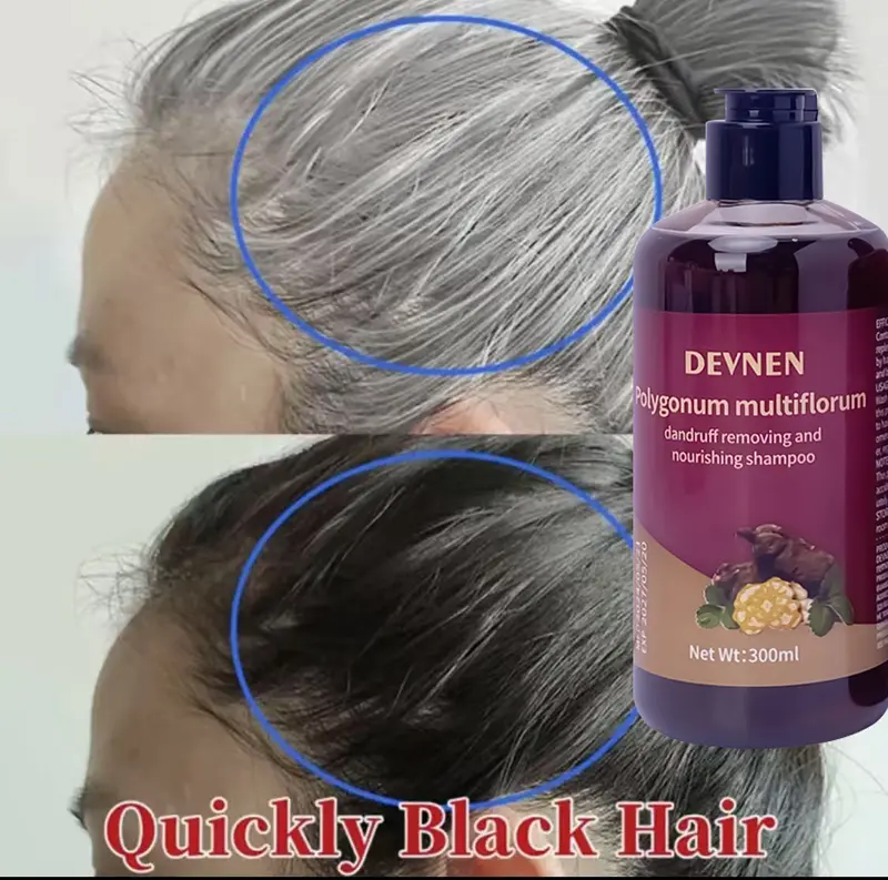 SHAMPO Black Herbal Natural Penyamar Rambut dan Penghiang uban Usia Muda 300ml Shampoo Herbal Polygonum Penghitam Rambut Hitam Dalam Sampo Ketombe Sampo Menghitamkan  Conditioner 2