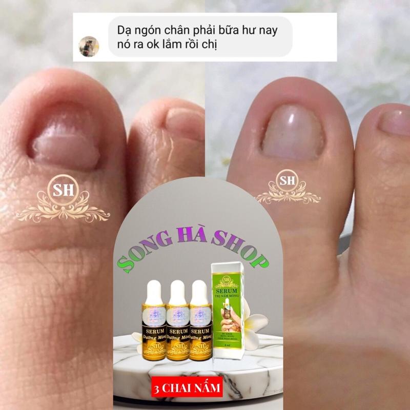{CHÍNH HÃNG SH} 03 chai serum trị nấm móng, bọng móng, hư khoé, móng bị hư tổn dưỡng  móng