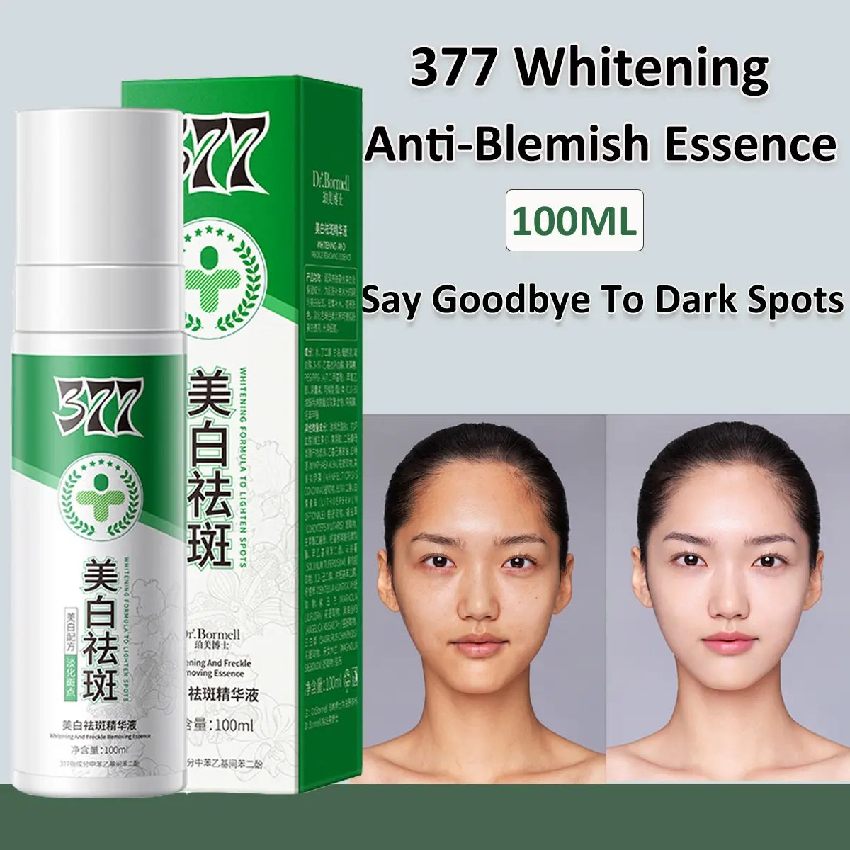 Tinh Chất Chống Tàn Nhang 377, Hiệu Quả Để Phục Hồi Da Xỉn Màu, Huyết Thanh Và Kem Chống Lão Hóa, Công Thức Nhẹ Nhàng, Làm Mờ Vết Thâm Và Nám, Thích Hợp Để Chống Lão Hóa, [Nói Tạm Biệt Với Vết Thâm Đen]