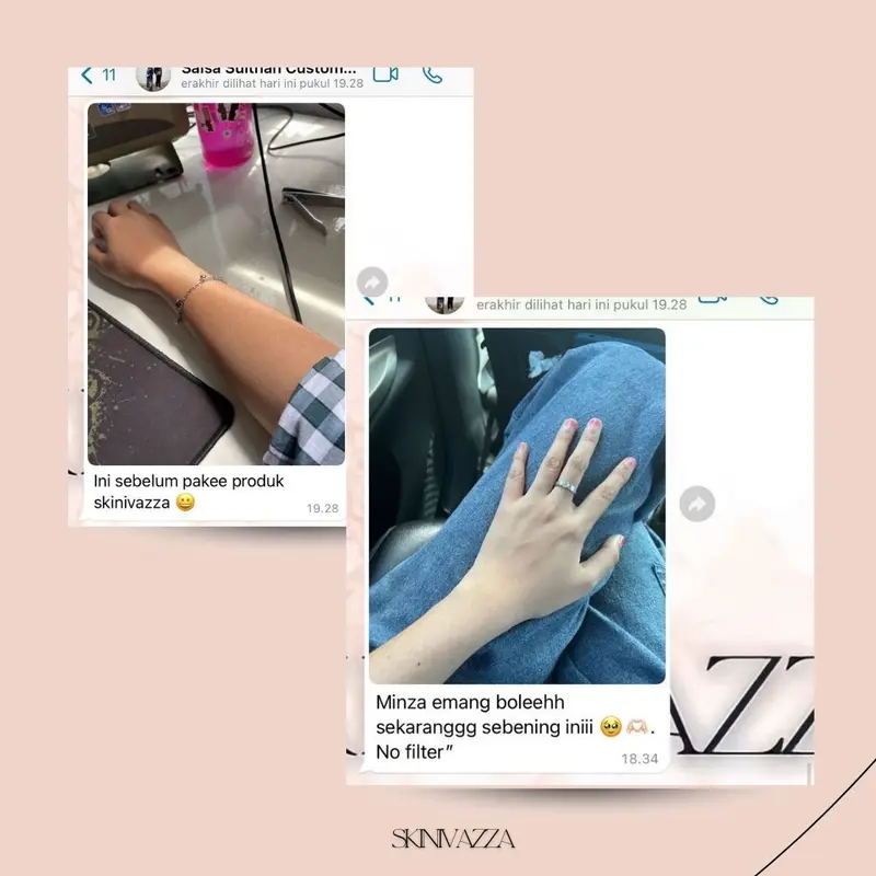 SKINIVAZZA - Salmon-DNA Extra Chromabright Whitening Lotion 4