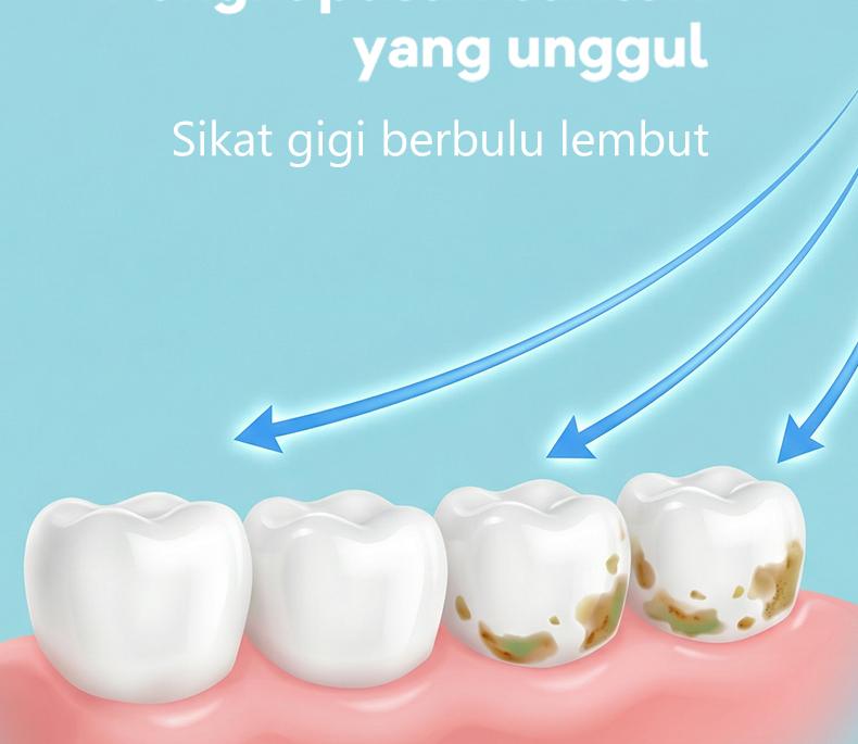 DDAILYLIFE Sikat Gigi Soft Sikat gigi perjalanan Perawatan ganda berbululembut
