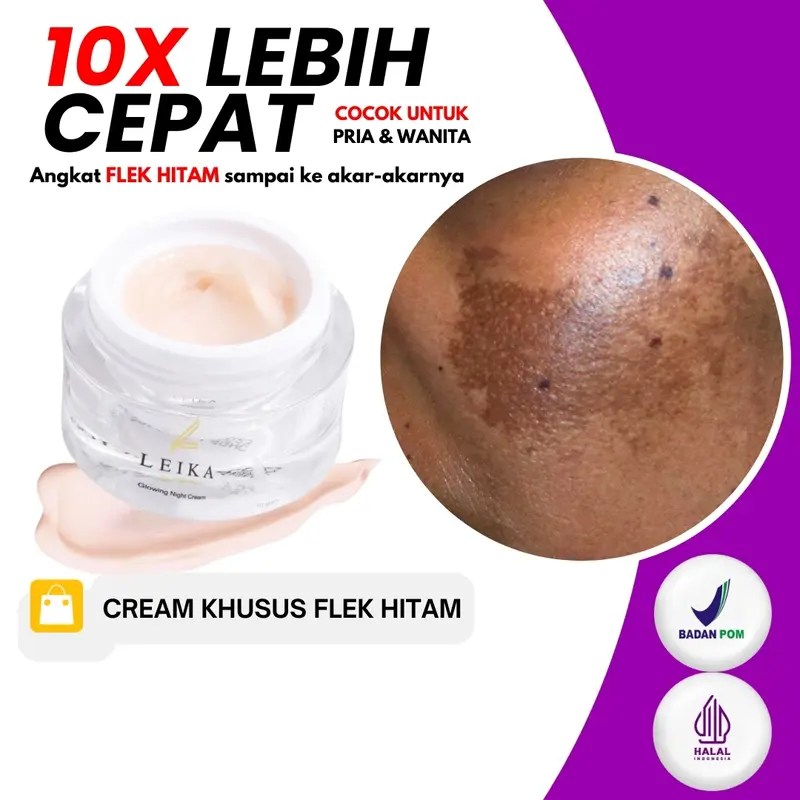 [ BISA COD ] Cream penghilang flek hitam melasma bpom Flek Hitam Membandel Melasma Ampuh Salep Cina ampuh Penghilang Flek Hitam Membandel Di Wajah Paling Ampuh Permanen Cream Penghilang Flek Hitam Permanen Bisa Untuk Wanita dan Pria Leika Skincare 0