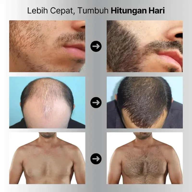 COPILOT HAIR BOOSTER SERUM Penumbuh Rambut Botak, Pelebat rambut, mempercepat pertumbuhan rambut 4