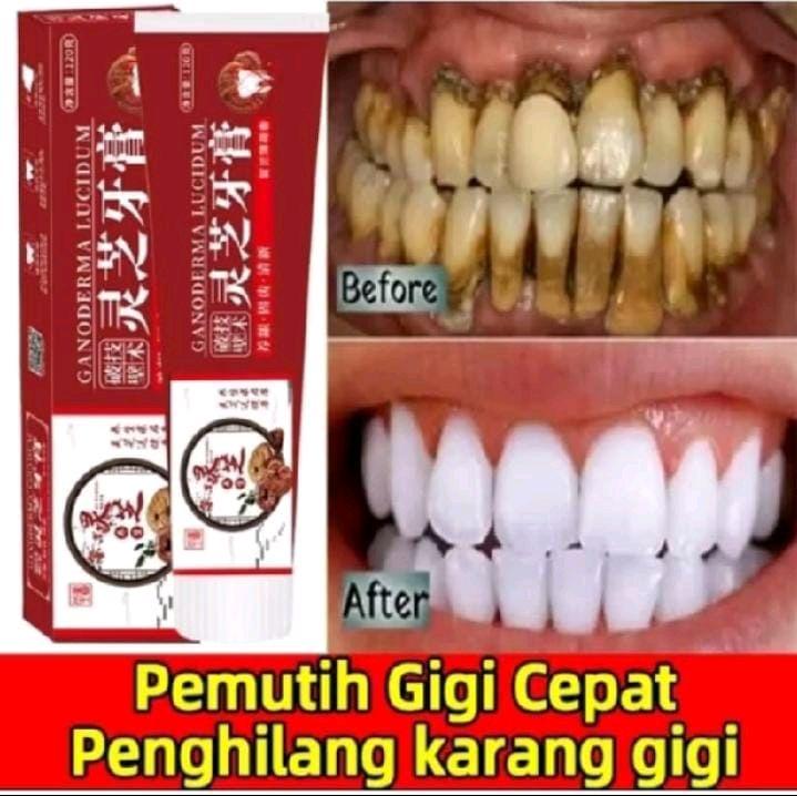 Lingzhi Toothpaste Pasta Gigi Pemutih Memutihkan Gigi Kuning Penghilang Karang Gigi Dan Pemutih Gigi Permanen 120g Odol Pembersih Karang Gigi Perawatan Pemutihan Gigi / Menghilangkan Bau Mulut/Perontok Karang Gigi/ Noda Asap / Menghilangkan Noda Teh 0