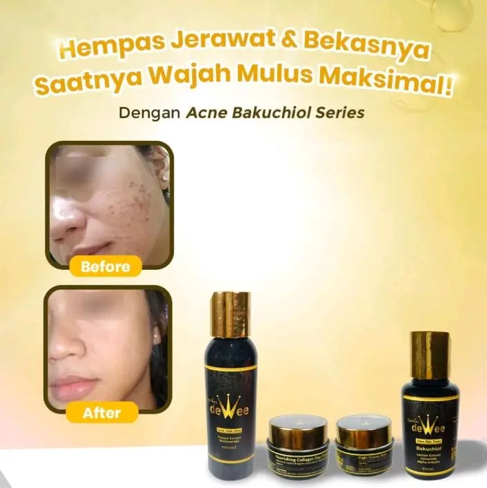 Dewee kemilau dewe paket bandel / paket bakuchiol buat flek/acne/susah putih