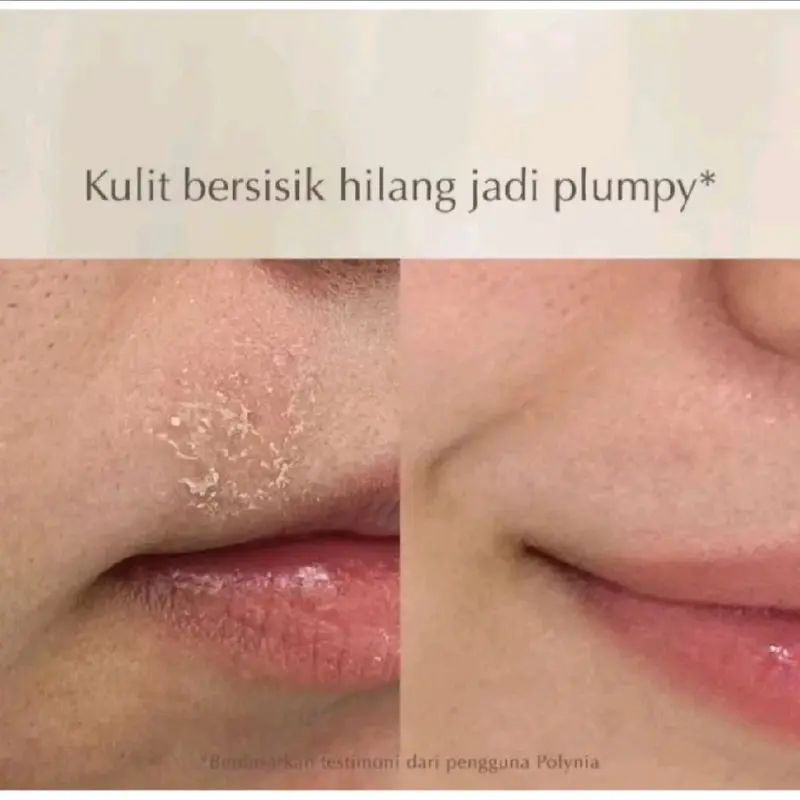 POLYNIA |Pomegrante revitalizing botox mask | Orange Brightening | pickly pear Hydrating | shiconix soothing mask 6