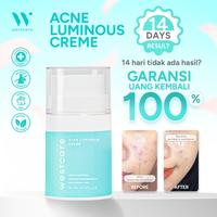 Gambar [DISKON 90%] Westcare Acne Luminous Creme 30ml - ED JANUARI 2026 - 30 ml dari Westcare Skincare Kab. Tangerang 1 Tokopedia