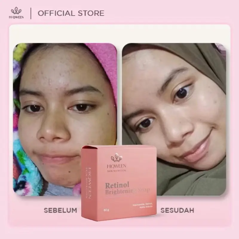 Hiqween - Sabun RETINOL BRIGHTENING SOAP 80gr Original Bpom (Facial Wash Sabun Cuci Muka Pemutih Penghilang Flek Hitam) Distributor Resmi Pusat 1