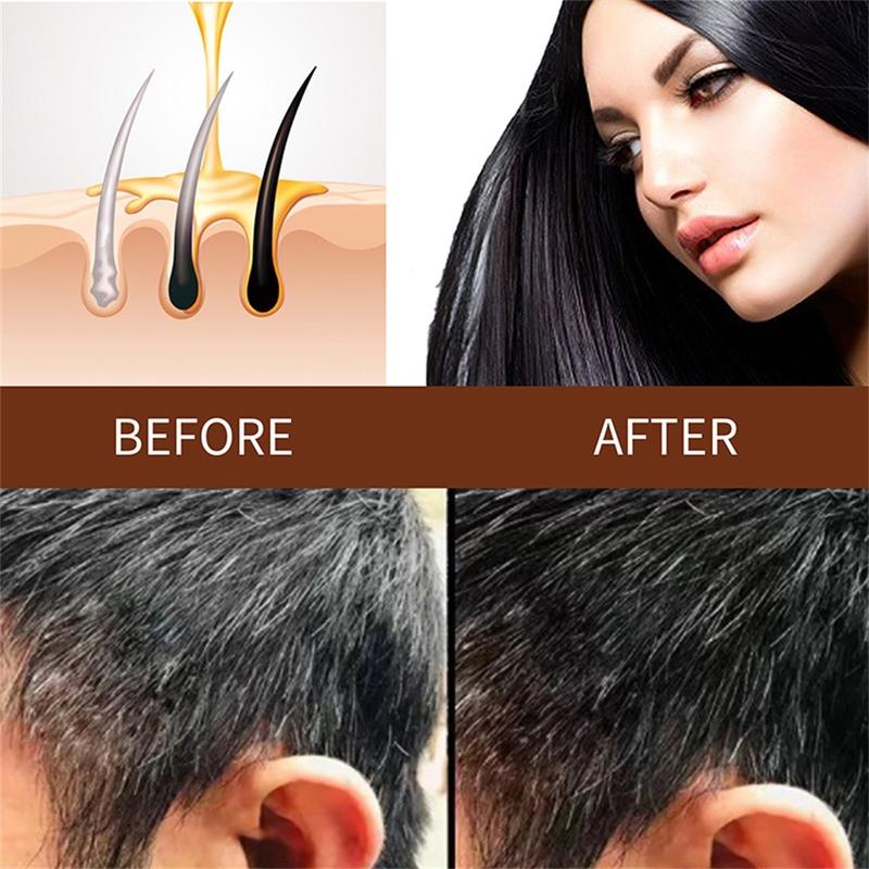 Product Introduction of Jaysuing 1pc Polygonum Multiflorum Shampoo Soap Natural Darkening Grey Hair onerryph Fragrance Free 0