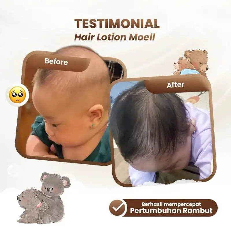 Moell Hair Care - (Shampoo 185ml & Hair Lotion 100ml) - Hair Care with Panax Ginseng, Kemiri, Biotin - Perawatan Rambut Bayi & Anak pikaru kondisioner sakura anti-ketombe Travel Smooth shampoo non rambut rontok Smoothing Keratin Haircare sampo penumbuh 5