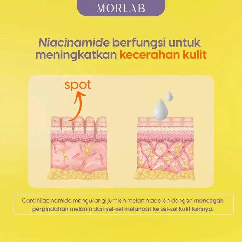 MORLAB-PAKET COMBO(1 PCS  V10 Vitamin Tone Up Cream +1 PCS NOURISHING ACNE) | Mencerahkan,Pelembab,Wajah, Anti-Aging No Alcoho & Fragrance 5
