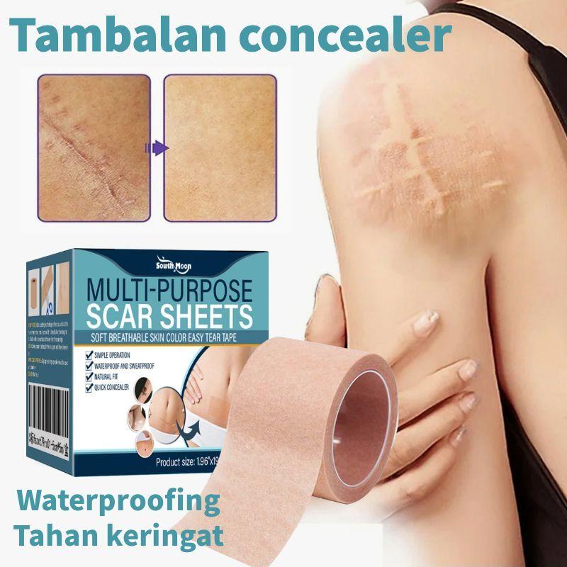 Silicone scar sheet Penutup bekas luka Penutup luka warna kulit Covering Patch Tambalan concealer penutup tattoo warna kulit stretch mark operasi cesar tanda lahir - Beli 3 Gratis 2