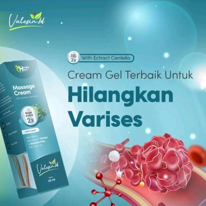 valesin obat varises ori menghilangkan varises di dalam kaki 0
