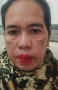 Product Review of YOUBUY Whitening Cream krim pemutih wajah Help Light Dark spots Flek Hitam Brightening Lightening  membantu Pemutihan menerangi Meringankan bintik hitam skincare Serum from A**H M**. 1