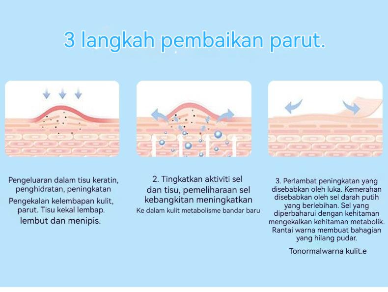 【COD】Krim Perbaiki Bekas Lahir & Parut - Memperbaiki dan Menyembuhkan Tato, Parut, dan Luka Jahitan Operasi - 20g